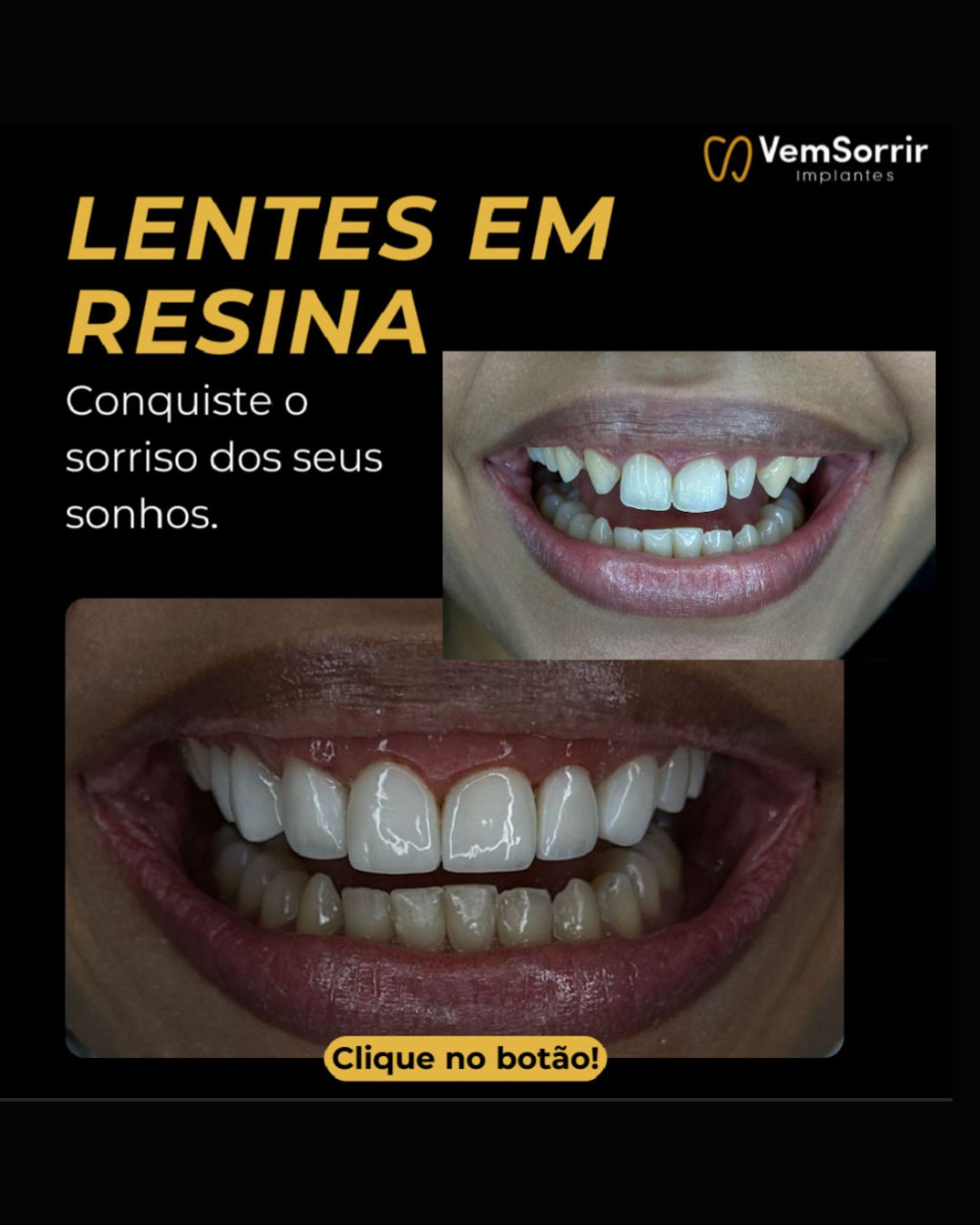 facetas 1 (1)